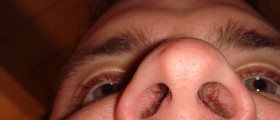Are Your Nose Bacteria Going To Save The World? (Finally, New Antibiotic Discovered!)