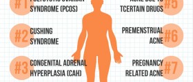 8 Medical Conditions That Might Cause Your Adult Acne
