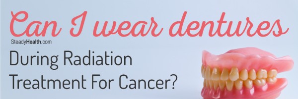 Can I Wear Dentures During Radiation Treatment For Cancer?