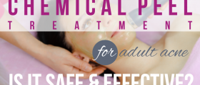 Chemical Peel Treatment For Adult Acne: Is It Safe And Effective?