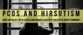 PCOS And Hirsutism: How Can You Get Rid Of Excess Hair Growth Caused By Polycystic Ovary Syndrome?