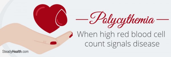 Polycythemia: When High Red Blood Cell Count Signals Disease