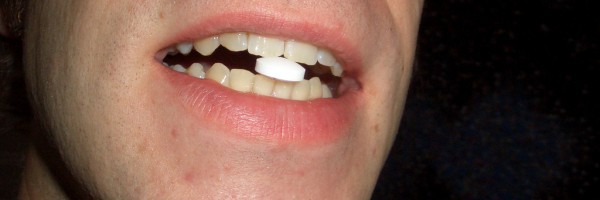 Anti-Inflammatory Drugs for Depression: Can an Aspirin a Day Keep The Blues Away?