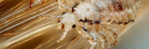 Lice Epidemic Makes Nitpicking A New American Obsession