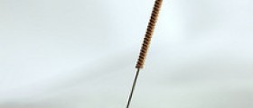 Infertility and Acupuncture: Experts Warn of Acupuncture Infection Risk