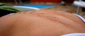 Acupuncture Treats Infertility with Adenosine
