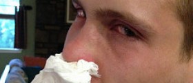 Chronic runny nose