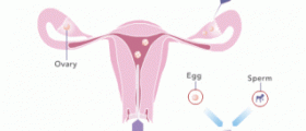 What does unsuccessful IVF have to do with organ transplants?