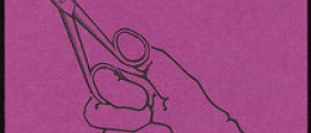 Does episiotomy cause incontinence in women?