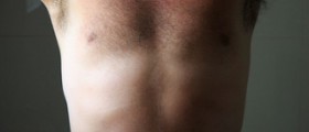 Do you have constant pain under your left rib cage?