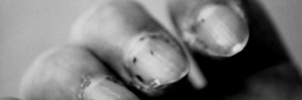 Fingernail pain and discomfort