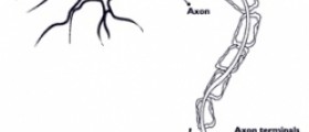CIDP - autoimmune disease