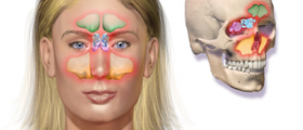 How to treat a sinus infection