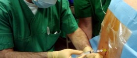 Headache after epidural anesthesia