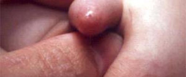 Hard Uncircumsized Penis 36