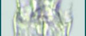 About parasitic nematodes