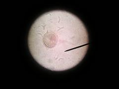 About roundworm facts
