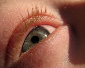 Allergies of the eyes