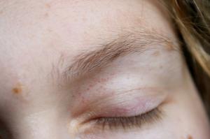 Anti-aging eye cream