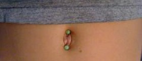 Belly button ring infection