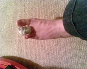 Broken toe - what to do