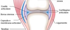 Calcium build up in joints