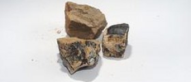 Calcium deposits facts