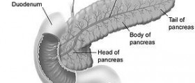 Chronic duodenitis treatment
