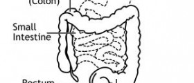 Chronic dyspepsia symptoms
