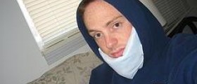 Chronic jaw pain