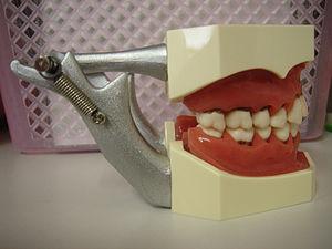 Chronic jaw popping