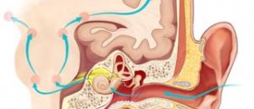 Chronic labyrinthitis facts