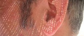 Chronic middle ear infection