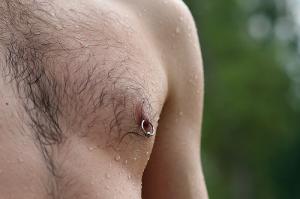 Complications of nipple piercing