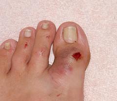 skin problems on feet #9