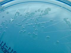 E coli infection