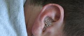 Ear problem won't go away