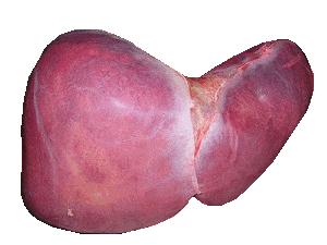 End stage of primary biliary cirrhosis
