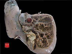 Endocrine pancreas function