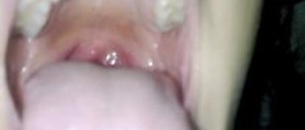 Esophageal cancer staging