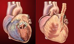 Estrogen and cardiovascular disease