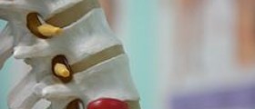 Exercise for people with herniated disc