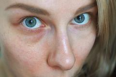 Fine lines under eyes