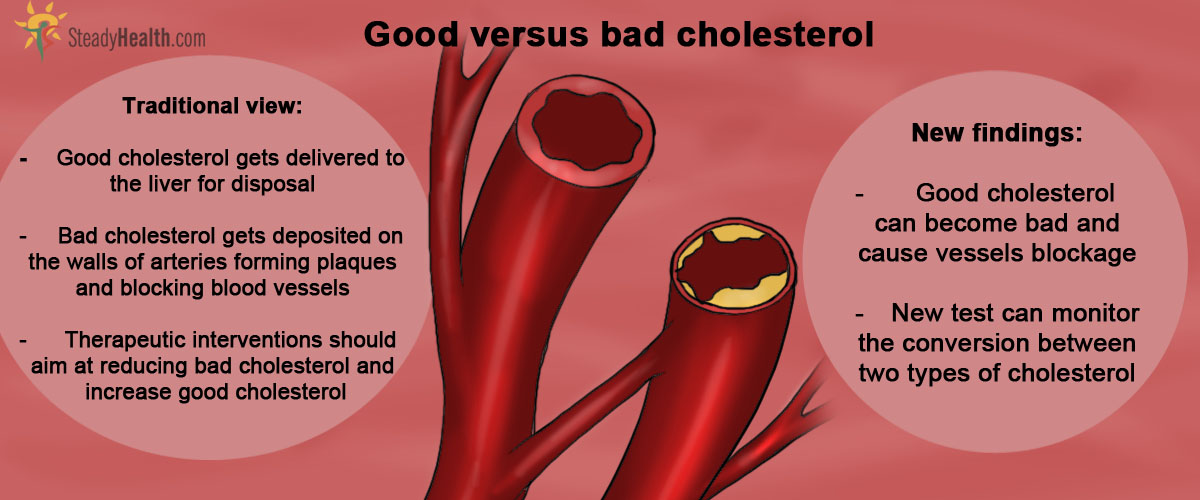 "Good" And "Bad" Cholesterol Not As Simple As It Sounds