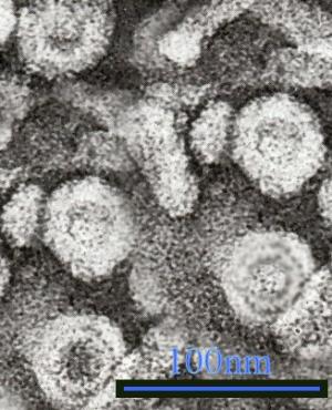 Hepatitis-B: An unignorable plague