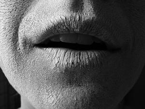 Herbs for dry mouth