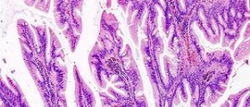 How is sigmoidoscopy procedure done