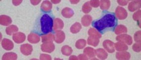 Infectious Mononucleosis: Recovery time & complications