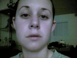 Facial Swelling In The Morning 41