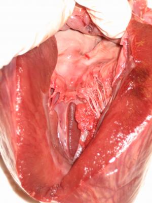 Lining of the heart